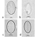 Cocconeis placentula Ehrenberg, 1838