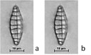 Denticula tenuis Kützing, 1844