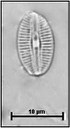 Diploneis oblongella (Nägeli ex Kützing) Cleve-Euler in Cleve-Euler & Osvald, 1922