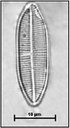 Lemnicola hungarica (Grunow) Round & Basson,1997